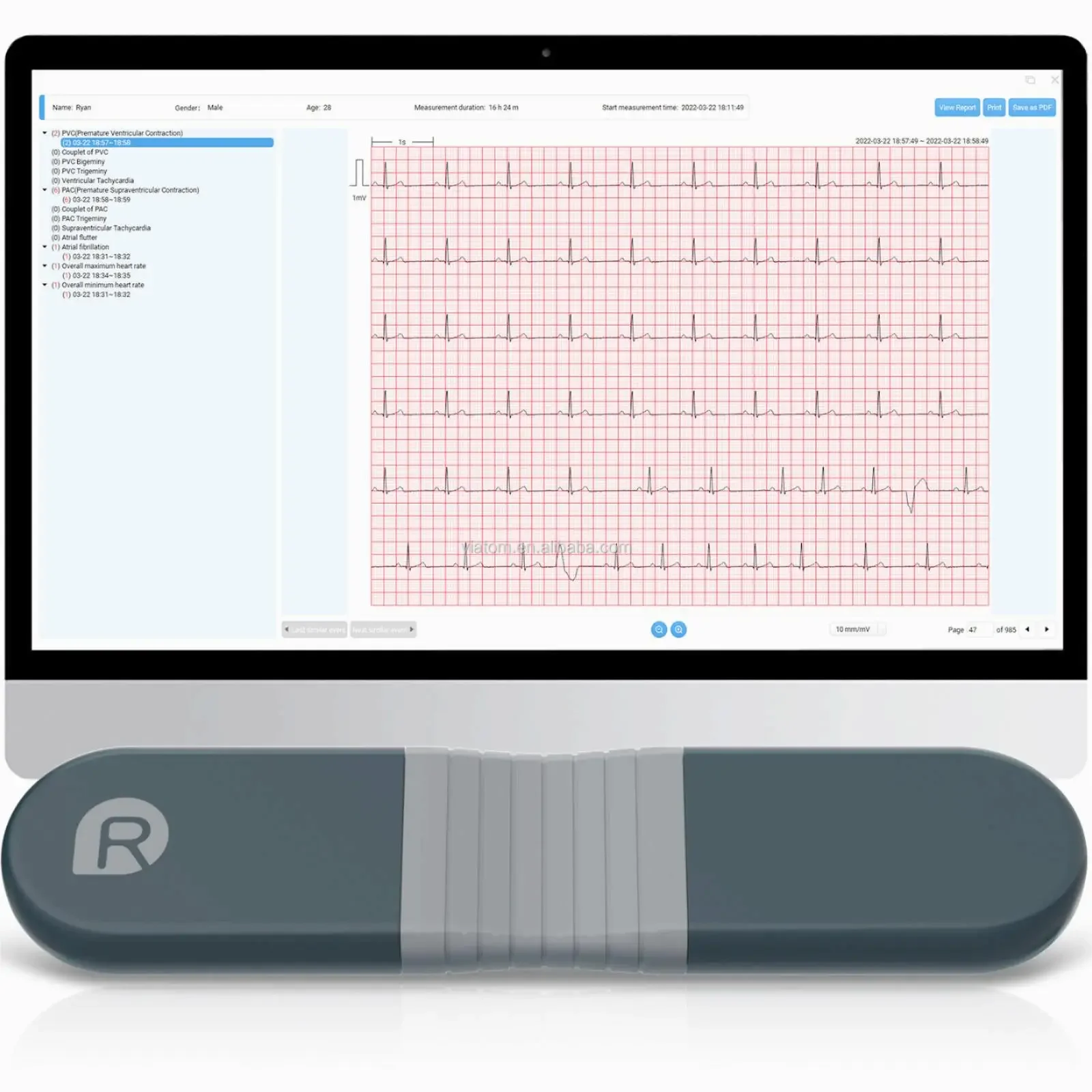 Wireless Bluetooth Dynamic Rec - Ecg Patch Monitor incelemesi ve fiyatı